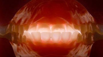 Improving Your Image: Dental Photography in Practice