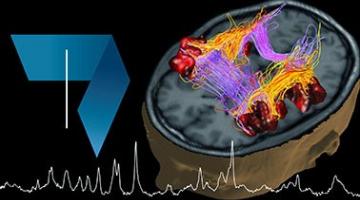 Fundamentals of Biomedical Imaging: Magnetic Resonance Imaging (MRI)